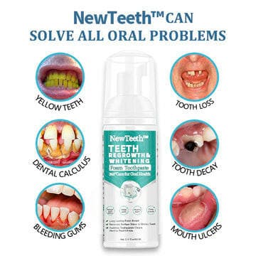 NEWTEETH™ TOOTHPASTE MOUSSE FOAM, CALCULUS REMOVAL, TEETH WHITENING, HEALING MOUTH ULCERS, ELIMINATING BAD BREATH, PREVENTING AND HEALING CARIES, TOOTH REGENERATION