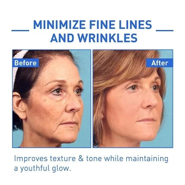 (✨Buy 2 Get 1 Free💕) Instant Wrinkle Eye Tightener cream🔥Last Day Sale 50% OFF🔥