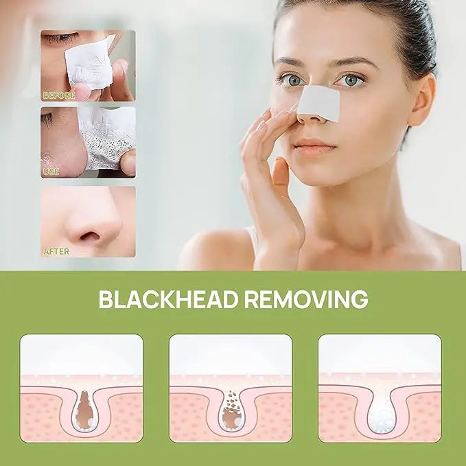 🔥 Blackhead Remover Peel Off Mask (🔥BUY 2 GET EXTRA 10% OFF🔥)