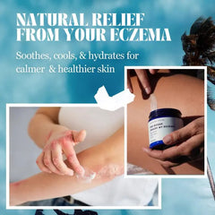 ✨This Week's Special Price $19.99💥All Natural Eczema Soothing Cream