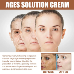 💥Big Discount Today -2024 New Anti-aging Whitening and Freckle Removal Cream