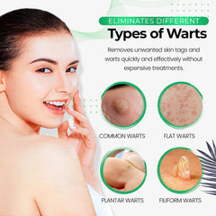 Wart Eliminator Soap