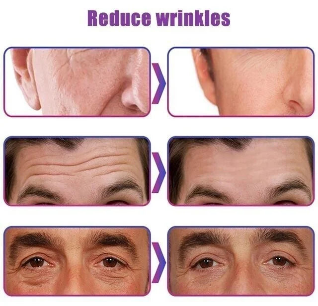 Anti-Aging Wrinkle Cream-(BUY 2 GET 1 FREE🎁BUY 3 GET 2 FREE🎁BUY 5 GET 3 FREE)